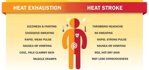 Heat Exhaustion Vs Heat Stroke