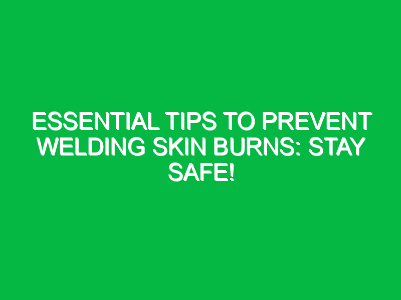 Essential Tips to Prevent Welding Skin Burns: Stay Safe!